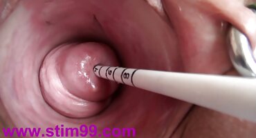 ഡബ്ല്യു. ഡബ്ല്യു. സി. സിയുടെ ചിത്രീകരണത്തിനിടെ യുവാവ് കുത്തേറ്റ് മരിച്ചു